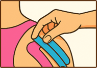 Kineziotape